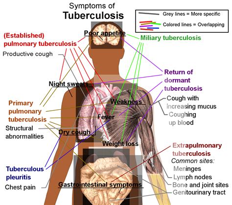 how does tuberculosis affect the respiratory system.